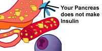 Your pancreas does not make insulin